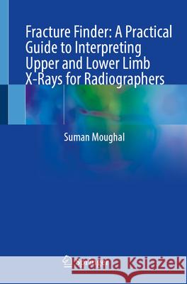 Fracture Finder: A Practical Guide to Interpreting Upper and Lower Limb X-Rays for Radiographers Suman Moughal 9783032173232 Springer - książka