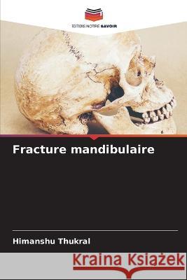 Fracture mandibulaire Himanshu Thukral   9786205662724 Editions Notre Savoir - książka