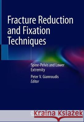 Fracture Reduction and Fixation Techniques: Spine-Pelvis and Lower Extremity Giannoudis, Peter V. 9783030246075 Springer - książka