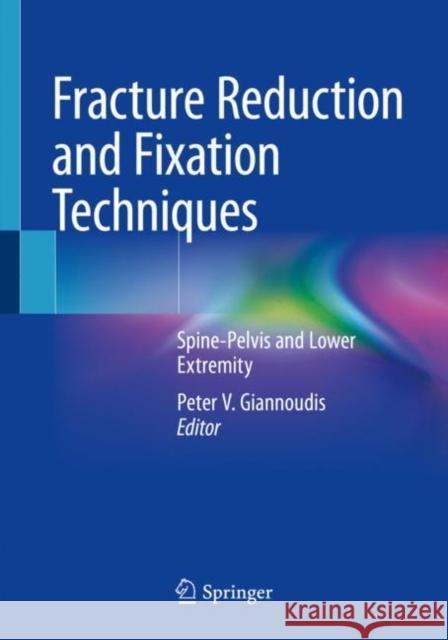 Fracture Reduction and Fixation Techniques: Spine-Pelvis and Lower Extremity Peter V. Giannoudis 9783030246105 Springer - książka