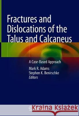 Fractures and Dislocations of the Talus and Calcaneus: A Case-Based Approach Adams, Mark R. 9783030373627 Springer - książka