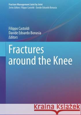 Fractures Around the Knee Castoldi, Filippo 9783319288048 Springer - książka