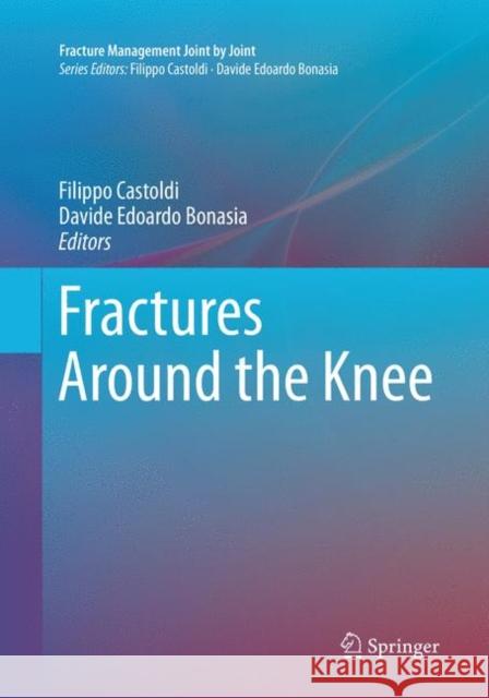 Fractures Around the Knee  9783319804309 Springer - książka