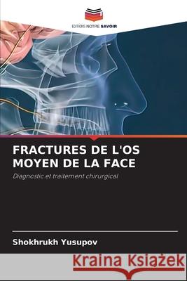 Fractures de l'Os Moyen de la Face Shokhrukh Yusupov 9786207894239 Editions Notre Savoir - książka