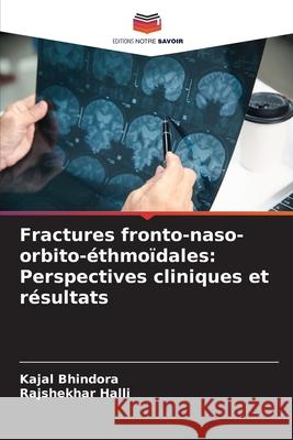 Fractures fronto-naso-orbito-?thmo?dales: Perspectives cliniques et r?sultats Kajal Bhindora Rajshekhar Halli 9786209226687 Editions Notre Savoir - książka