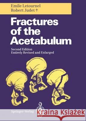 Fractures of the Acetabulum Emile Letournel Robert Judet Reginald A. Elson 9783642754371 Springer - książka