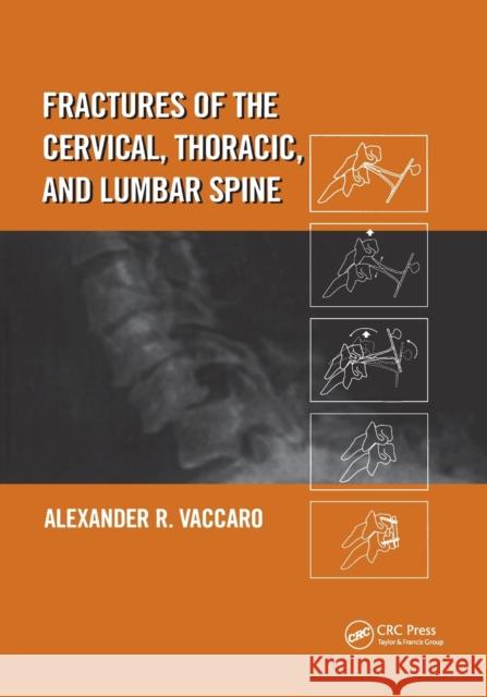 Fractures of the Cervical, Thoracic, and Lumbar Spine Alexander R. Vaccaro 9780367395797 CRC Press - książka