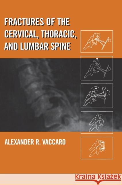 Fractures of the Cervical, Thoracic, and Lumbar Spine Zory V. Todres Alexander R. Vaccaro Vaccaro 9780824707132 Informa Healthcare - książka