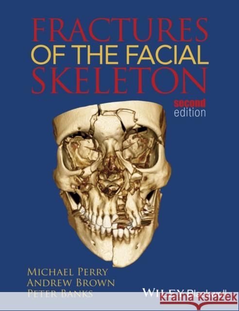 Fractures of the Facial Skeleton Perry, Michael; Brown, Andrew K.; Banks, Peter 9781119967668 John Wiley & Sons - książka