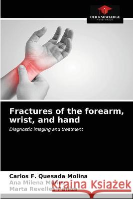 Fractures of the forearm, wrist, and hand Carlos F Quesada Molina, Ana Milena Muñoz, Marta Revelles Paniza 9786203332667 Our Knowledge Publishing - książka
