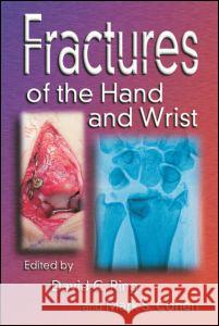 Fractures of the Hand and Wrist David C. Ring Mark S. Cohen 9780824728458 Informa Healthcare - książka