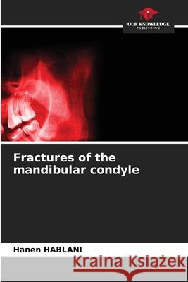 Fractures of the mandibular condyle HABLANI, Hanen 9786209036378 Our Knowledge Publishing - książka