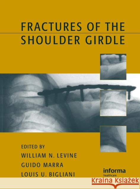 Fractures of the Shoulder Girdle Henry C. Thode William N. Levine Guido Marra 9780824708986 Informa Healthcare - książka