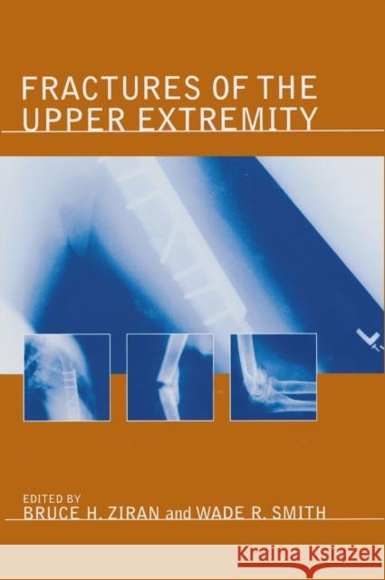 Fractures of the Upper Extremity Ziran H. Ziran Bruce H. Ziran Wade Smith 9780824747183 Informa Healthcare - książka