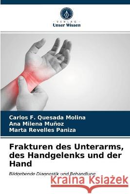 Frakturen des Unterarms, des Handgelenks und der Hand Carlos F Quesada Molina, Ana Milena Muñoz, Marta Revelles Paniza 9786203332650 Verlag Unser Wissen - książka