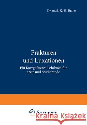 Frakturen Und Luxationen: Ein Kurzgefasstes Lehrbuch Für Ärzte Und Studierende Bauer, K. H. 9783642895180 Springer - książka