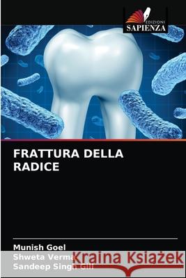 Frattura Della Radice Munish Goel, Shweta Verma, Sandeep Singh Gill 9786203350548 Edizioni Sapienza - książka