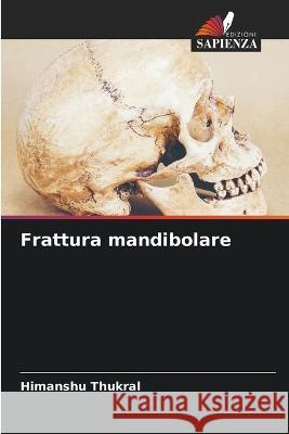 Frattura mandibolare Himanshu Thukral 9786205662731 Edizioni Sapienza - książka