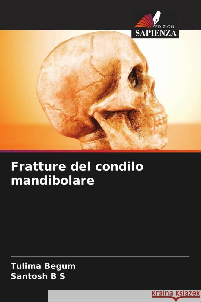 Fratture del condilo mandibolare Begum, Tulima, B S, Santosh 9786205145753 Edizioni Sapienza - książka