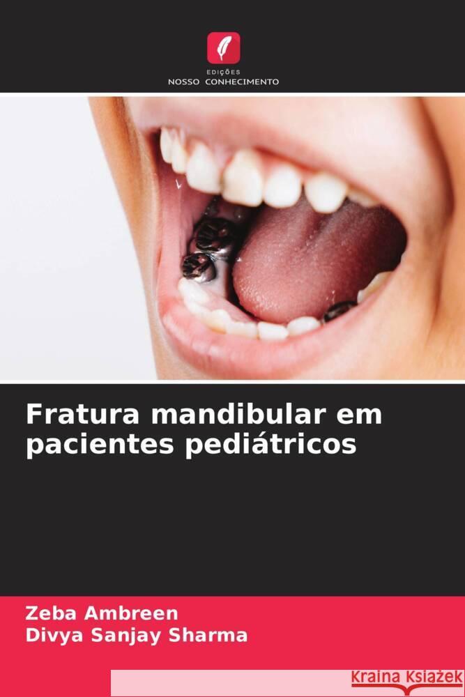 Fratura mandibular em pacientes pediátricos Ambreen, Zeba, Sharma, Divya Sanjay 9786202866958 Edições Nosso Conhecimento - książka