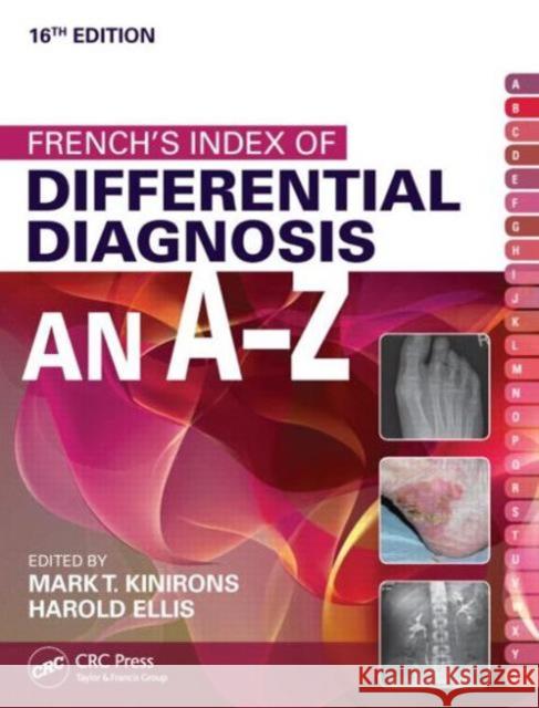 French's Index of Differential Diagnosis an A-Z Kinirons, Mark T. 9781482230703 CRC Press - książka