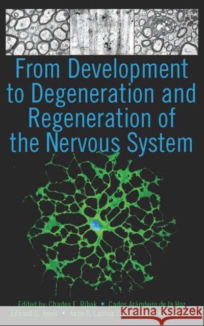 From Development to Degeneration and Regeneration of the Nervous System Charles E. Riba Carlos Arumbaro D Edward G., Jones 9780195369007 Oxford University Press, USA - książka