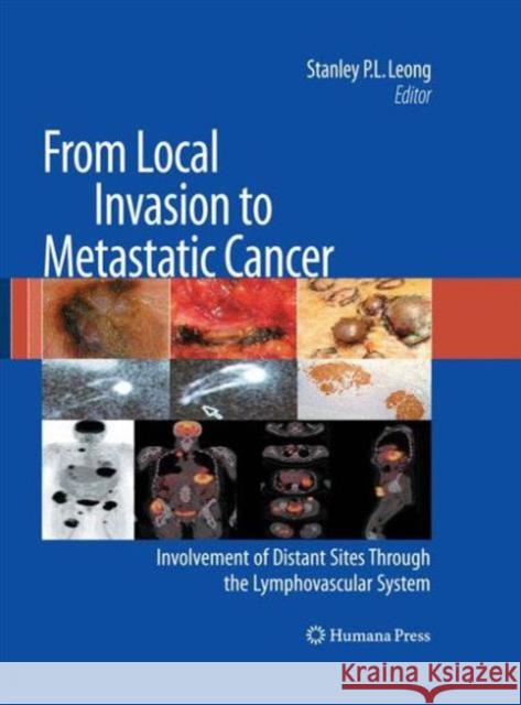 From Local Invasion to Metastatic Cancer: Involvement of Distant Sites Through the Lymphovascular System Leong, Stanley P. L. 9781627039437 Humana Press - książka