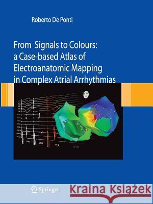 From Signals to Colours: A Case-Based Atlas of Electroanatomic Mapping in Complex Atrial Arrhythmias De Ponti, Roberto 9788847015586 Springer - książka