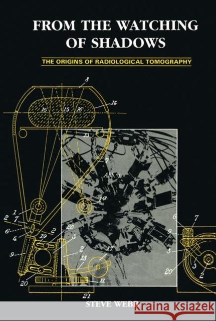 From the Watching of Shadows: The Origins of Radiological Tomography Steve Webb S. Webb Webb Webb 9780852743058 Taylor & Francis - książka