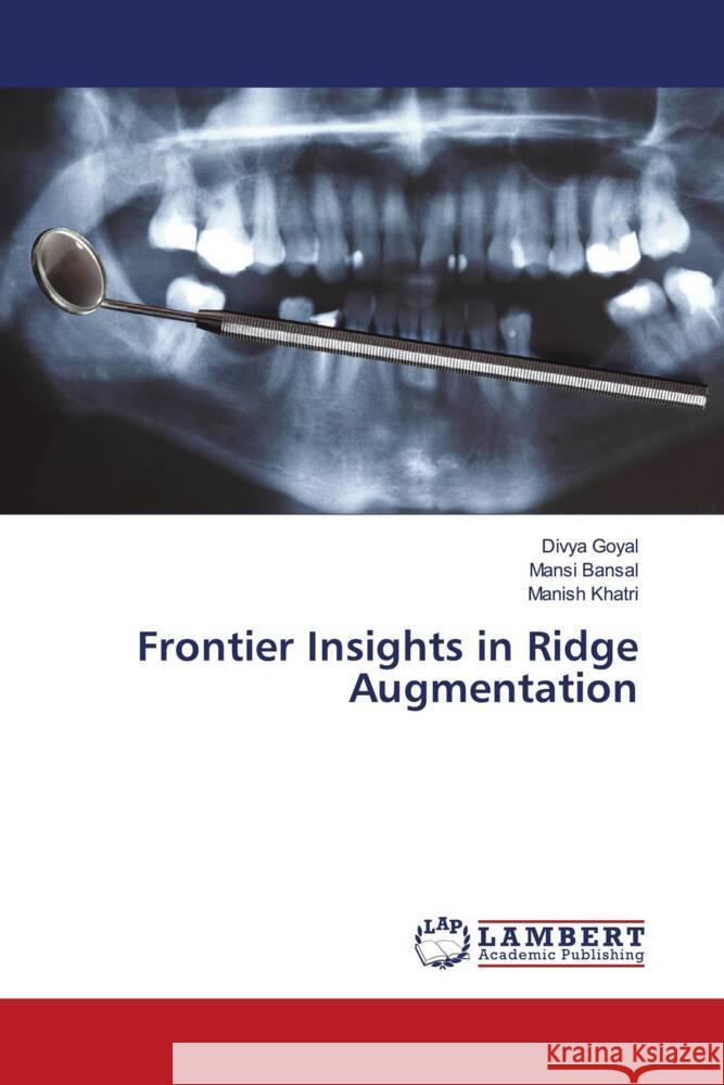 Frontier Insights in Ridge Augmentation Goyal, Divya, Bansal, Mansi, Khatri, Manish 9786206164494 LAP Lambert Academic Publishing - książka