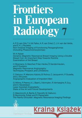 Frontiers in European Radiology  9783642756672 Springer - książka