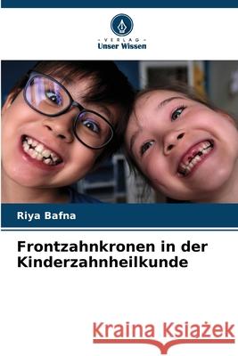 Frontzahnkronen in der Kinderzahnheilkunde Bafna, Riya 9786209140112 Verlag Unser Wissen - książka