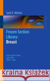 Frozen Section Library: Breast Syed K. Mohsin 9781461407171 Springer - książka