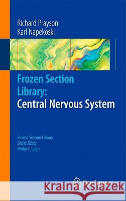 Frozen Section Library: Central Nervous System Richard Prayson Karl Napekoski 9781441975782 Springer - książka
