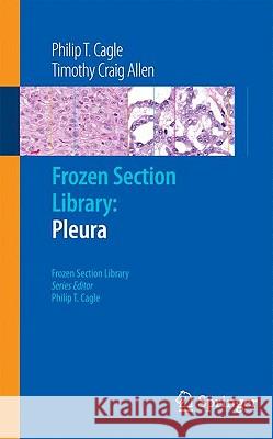 Frozen Section Library: Pleura Philip T. Cagle 9780387959856 Springer - książka
