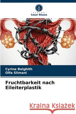 Fruchtbarkeit nach Eileiterplastik Cyrine Belghith, Olfa Slimani 9786204040912 Verlag Unser Wissen - książka
