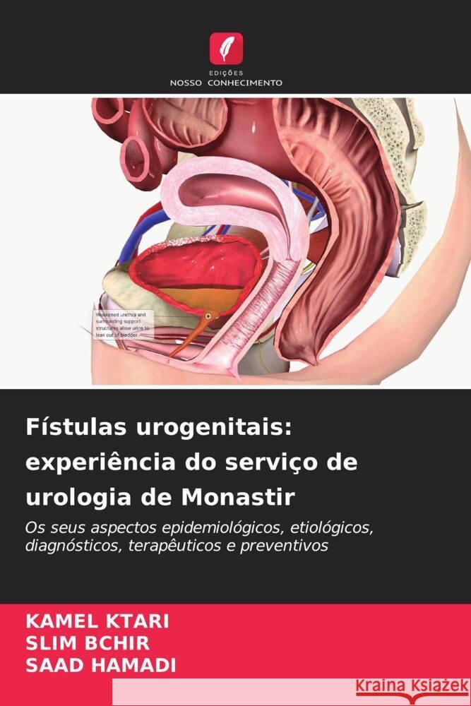Fístulas urogenitais: experiência do serviço de urologia de Monastir Ktari, Kamel, BCHIR, SLIM, HAMADI, SAAD 9786206521167 Edições Nosso Conhecimento - książka