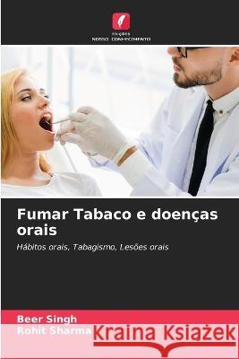 Fumar Tabaco e doencas orais Beer Singh Rohit Sharma  9786205968741 Edicoes Nosso Conhecimento - książka