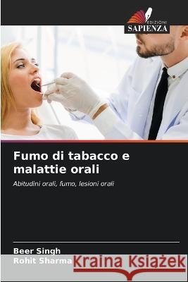 Fumo di tabacco e malattie orali Beer Singh Rohit Sharma  9786205968772 Edizioni Sapienza - książka