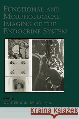 Functional and Morphological Imaging of the Endocrine System  9780792379348 KLUWER ACADEMIC PUBLISHERS GROUP - książka
