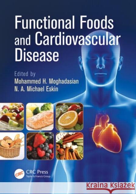 Functional Foods and Cardiovascular Disease Mohammed H. Moghadisian Michael Eskin  9781420071108 Taylor & Francis - książka
