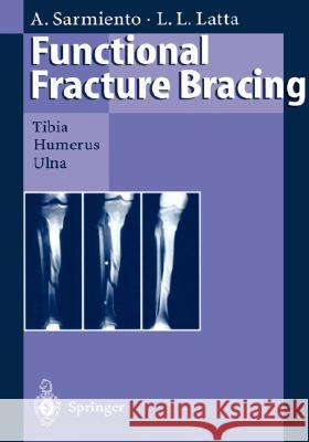 Functional Fracture Bracing: Tibia, Humerus, and Ulna Sarmiento, Augusto 9783540553564 Springer - książka