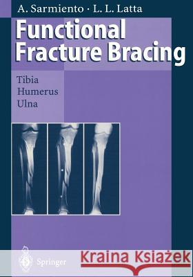Functional Fracture Bracing: Tibia, Humerus, and Ulna Sarmiento, Augusto 9783662030950 Springer - książka