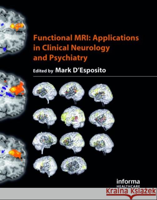 Functional MRI: Applications in Clinical Neurology and Psychiatry D'Esposito, Mark 9781842142950 Informa Healthcare - książka