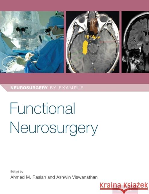 Functional Neurosurgery Ahmed Raslan Ashwin Viswanathan 9780190887629 Oxford University Press, USA - książka