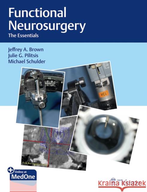 Functional Neurosurgery: The Essentials Brown, Jeffrey A. 9781626237742 Thieme Medical Publishers - książka