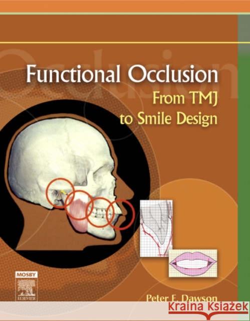 Functional Occlusion: From TMJ to Smile Design Peter E. Dawson 9780323033718 Elsevier - Health Sciences Division - książka