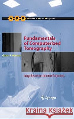 Fundamentals of Computerized Tomography: Image Reconstruction from Projections Gabor T. Herman 9781852336172 Springer London Ltd - książka