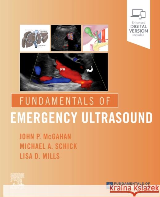 Fundamentals of Emergency Ultrasound John P. McGahan Michael A. Schick Lisa Mills 9780323596428 Elsevier - książka