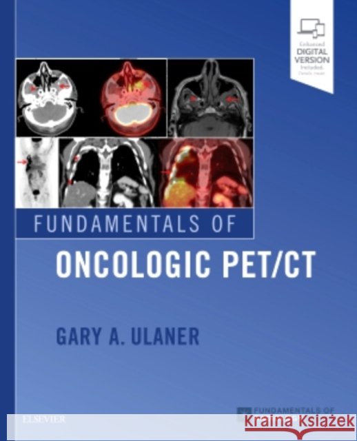 Fundamentals of Oncologic Pet/CT Gary A. Ulaner 9780323568692 Elsevier - książka